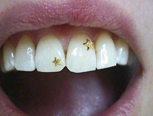 Декоративное украшение для зубов – SKYCE (Скайс) 