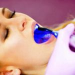 Лазерные технологии в стоматологии