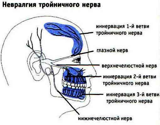 Воспаление тройничного нерва к стоматологу или неврологу 2