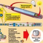 Ионная зубная щетка