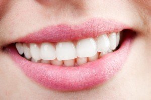 Домашнее отбеливание зубов: насколько это эффективно
