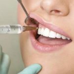 Анестезия при лечении зубов и ее виды