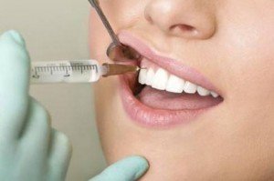 Анестезия при лечении зубов и ее виды