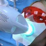 Фотоотбеливание – новый метод в стоматологии