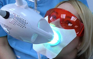 Фотоотбеливание – новый метод в стоматологии 