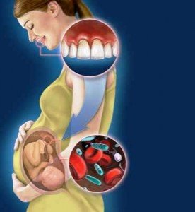 Беременность и здоровье зубов 
