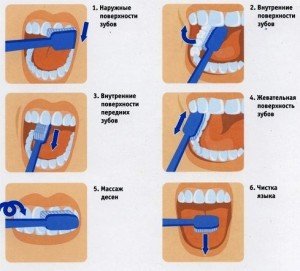 Уход за зубами и правила гигиены полости рта