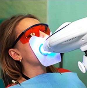 Профессиональное отбеливание зубов в стоматологии