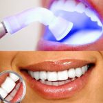 Отбеливание зубов лазером