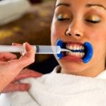 Отбеливание зубов: история и традиции