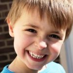 Проблемы с зубами у детей при неправильном прикусе, причины их возникновения
