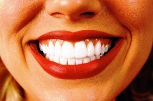 Отбеливание зубов. Какой он, путь к совершенству?