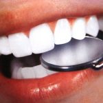 Эстетическая стоматология и гигиена полости рта в борьбе за красоту улыбки