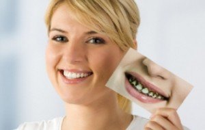 Керамическая коронка – первый помощник в реставрации зубного ряда
