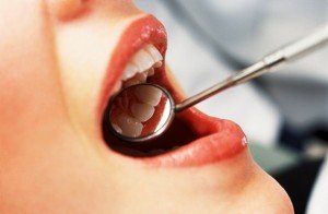 Отбеливание зубов: какой метод выбрать?