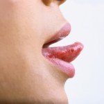 Неприятный запах изо рта и боль на кончике языка