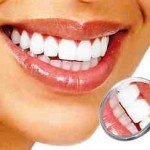 Система домашнего отбеливания зубов