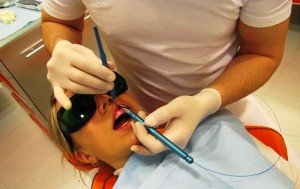 Отбеливание зубов – плюсы и минусы