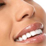 Отбеливание зубов: от каких продуктов питания воздерживаться после процедуры?