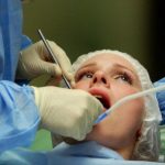 Нерв зуба: особенности удаления