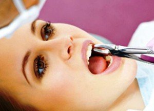 Удаление зуба: каких можно ждать осложнений?