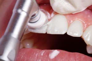 Гигиена полости рта в зрелом возрасте: нюансы ухода
