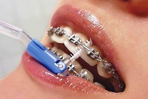 Зубные ершики – надежная страховка от стоматологических недугов