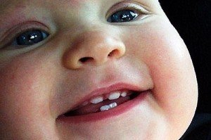 У ребенка болят зубы при прорезывании: что делать